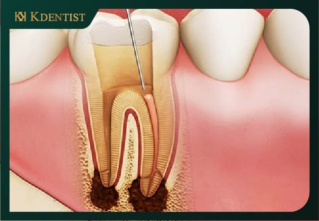 Gây tế cho bệnh nhân Gây tế cho bệnh nhân
