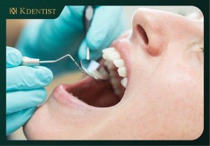 Điều trị cười hở lợi Điều trị cười hở lợi