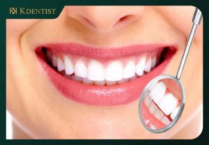 Bọc răng toàn sứ Bọc răng toàn sứ