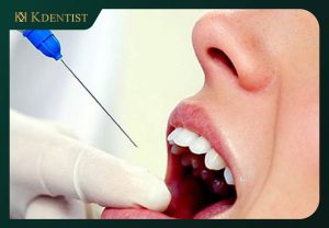 Gây tê trước khi tiểu phẫu Gây tê trước khi tiểu phẫu
