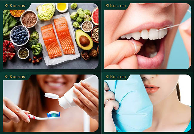 lưu ý sau khi trồng răng implant