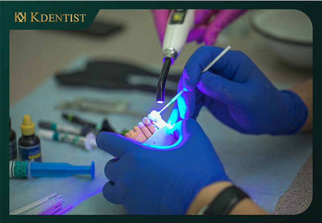 Quy trình trồng răng implant tại nha khoa