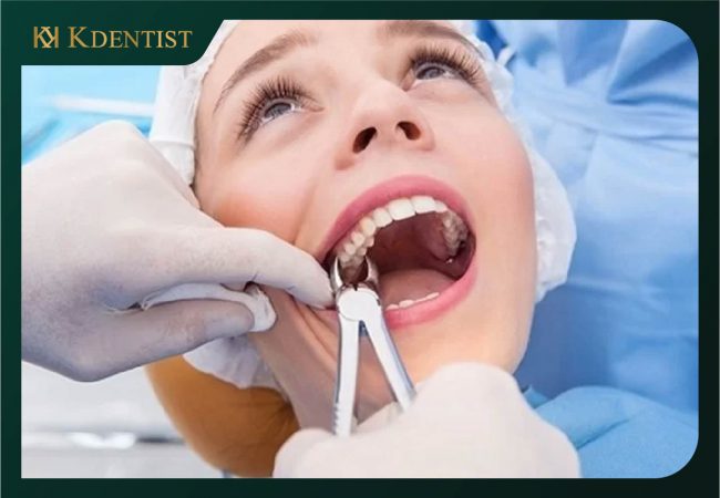 dịch vụ nhổ răng tại Quảng Ngãi dịch vụ nhổ răng tại Quảng Ngãi