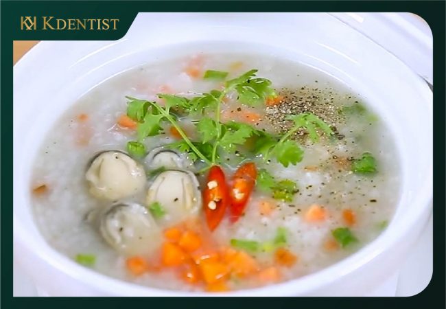 Niềng răng ăn cháo bao lâu Niềng răng ăn cháo bao lâu