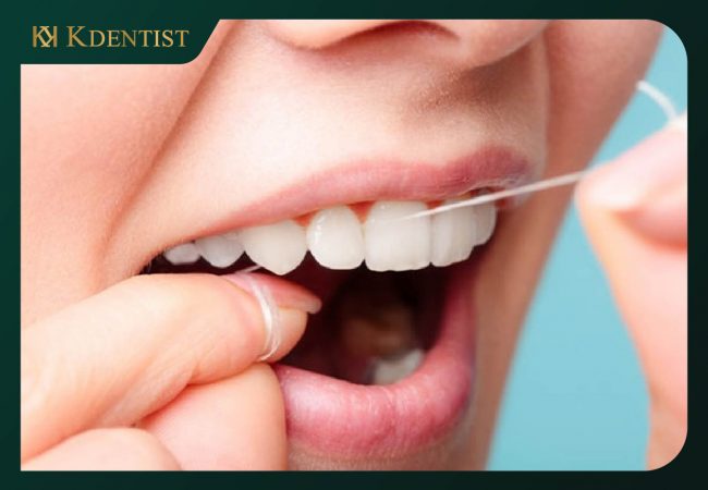 Hướng dẫn cách chăm sóc răng implant sau khi niềng răng Hướng dẫn cách chăm sóc răng implant sau khi niềng răng