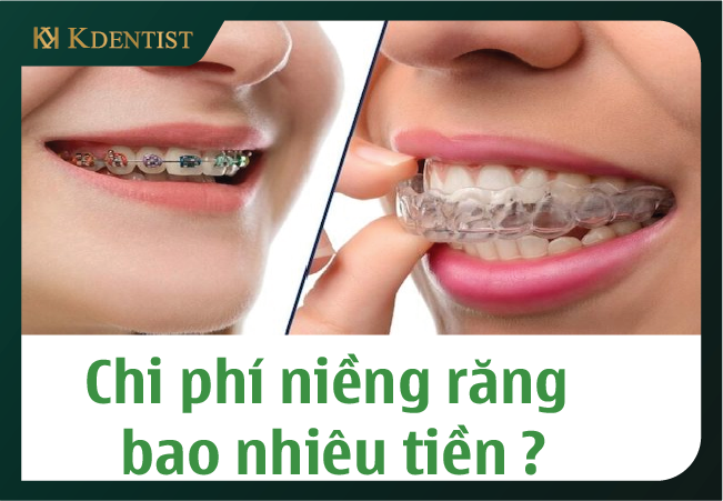 Kiểm tra tài chính Kiểm tra tài chính