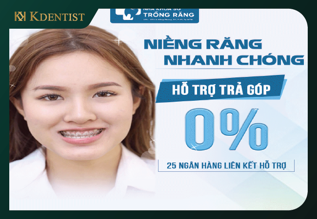 Giới thiệu hình thức niềng răng trả góp tại HH Dental